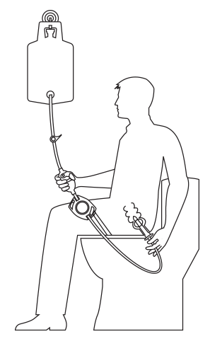Qufora Irrigation Qufora IrriSedo Klick Instructions For Use